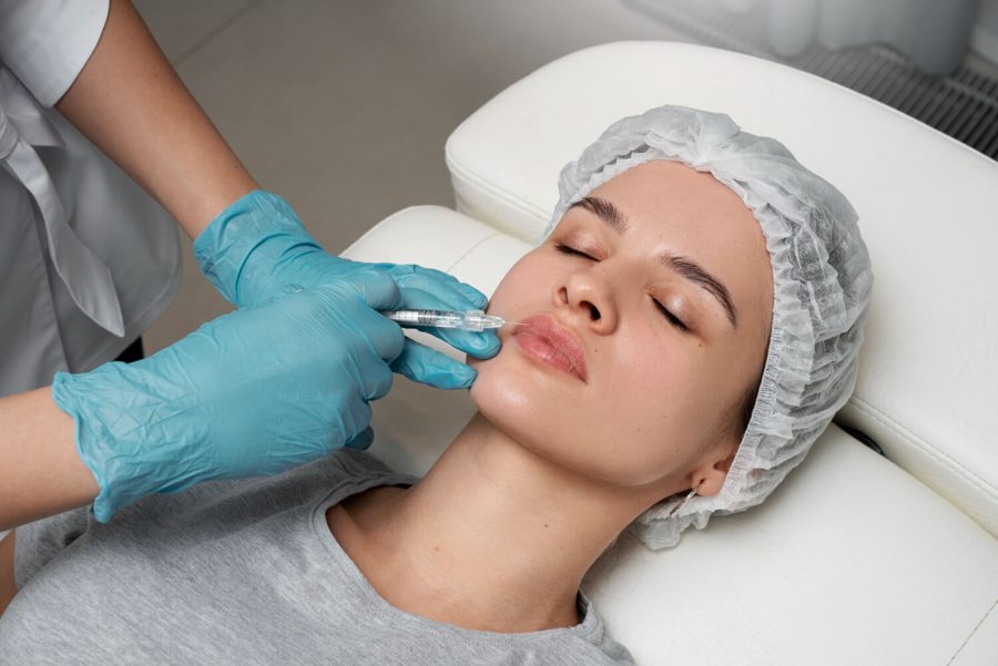 Lip Filler